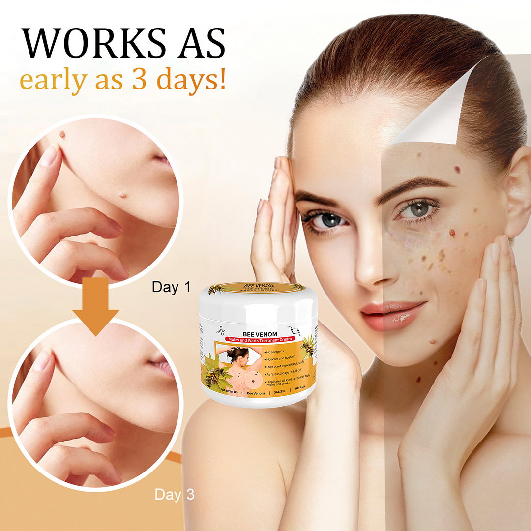 🐝🐝Bee Venom Mole and Wart Treatment Cream