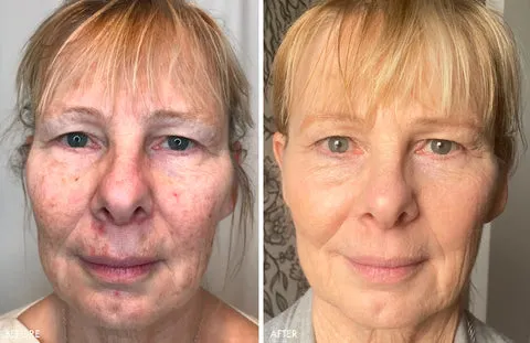 Newyuo™ Anti-Wrinkle & Firming Collagen Cream