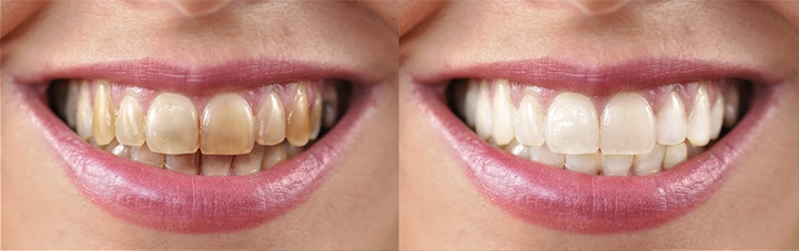 Rosopl® Multi-Action Oral Care Essence 27