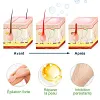 30ml Spray d'&Eacute;pilation sans douleur
