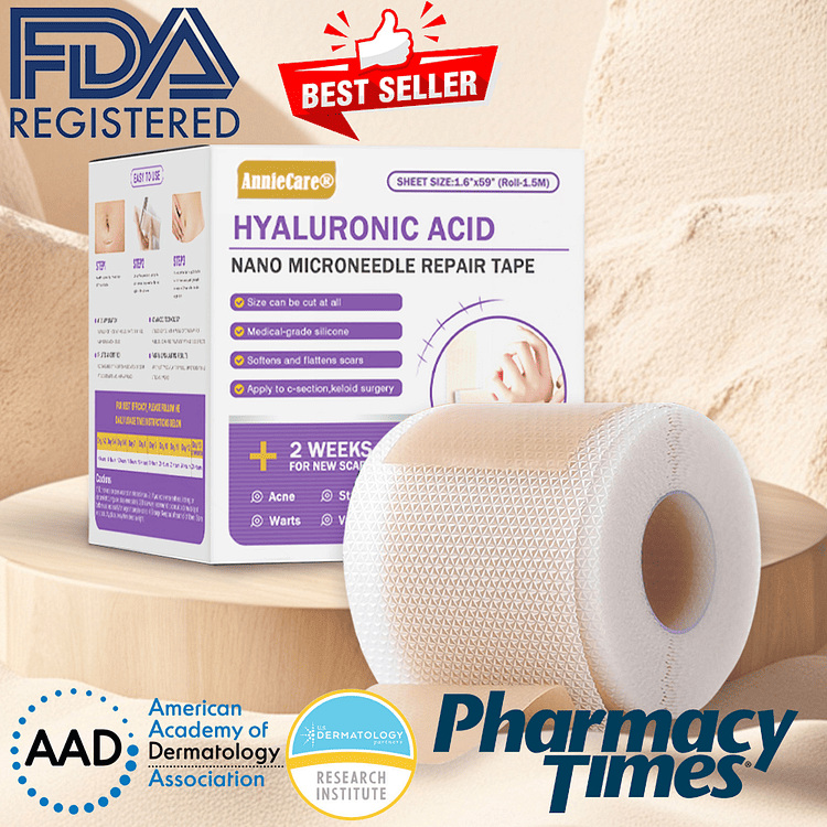 ✅Official Store |AnnieCare® Hyaluronic Acid Nano Microneedle Repair Tape🏥(Treatment of old and new scars, reduction of surgical scars, stretch marks, keloids, acne, burns, warts, dermatomes and varicose veins)