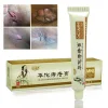 Chinese Herbal Hemorrhoids Cream Ointment Powerful Internal Piles External Anal Cream