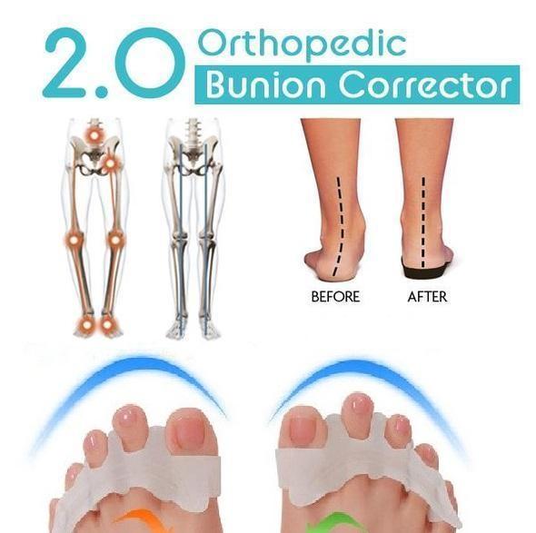Orthopedic Bunion Corrector, Big Toe Straightener Pain Relief  For Women & Men