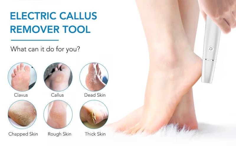 Electric Feet Callus Remover