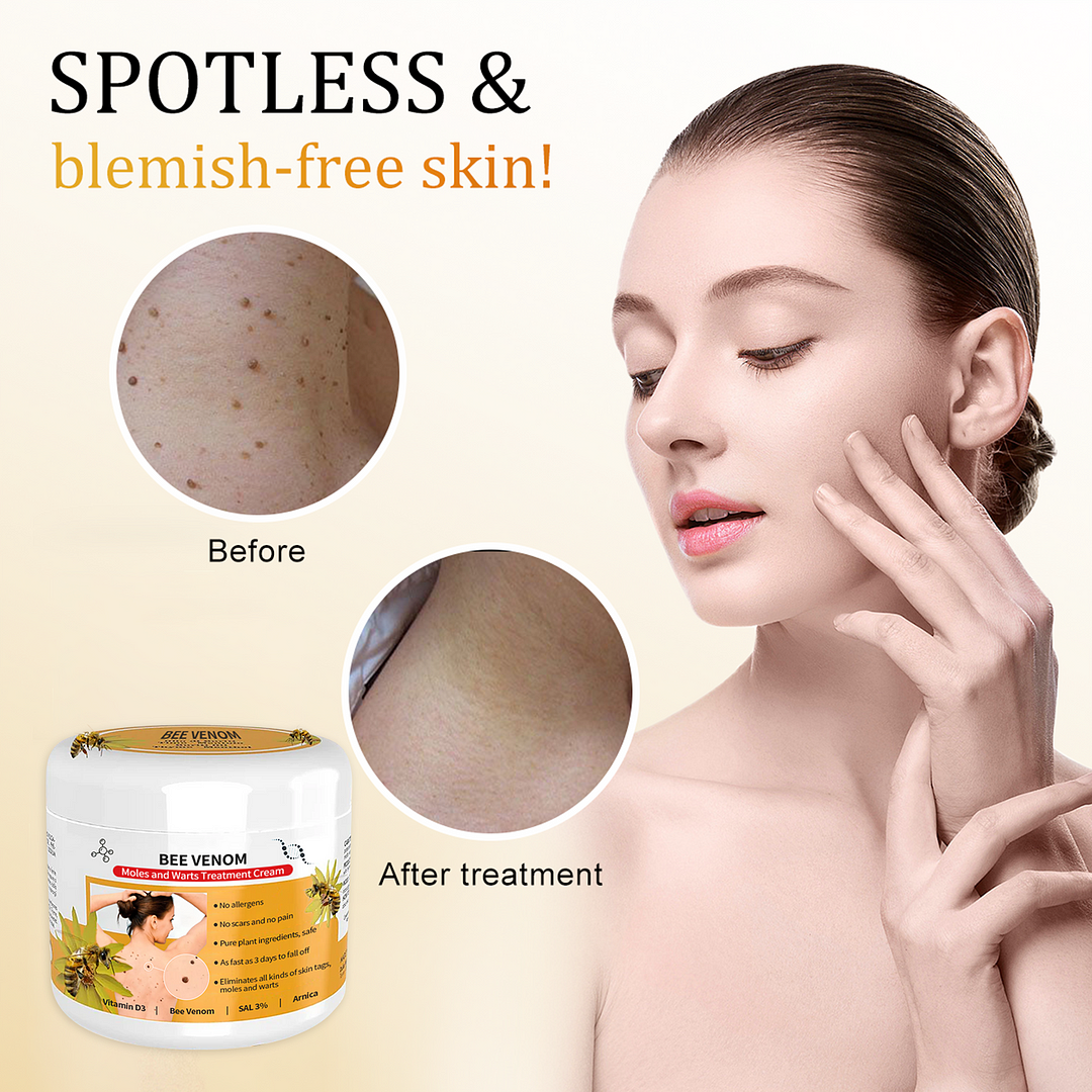 🐝🐝Bee Venom Mole and Wart Treatment Cream
