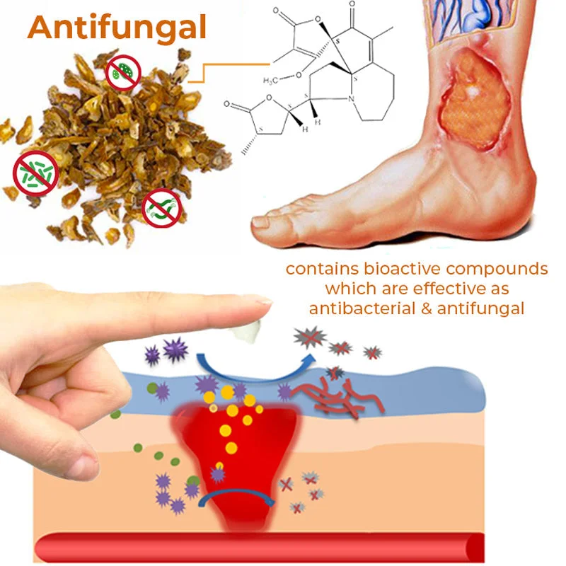 Bed Sore Treatment Cream