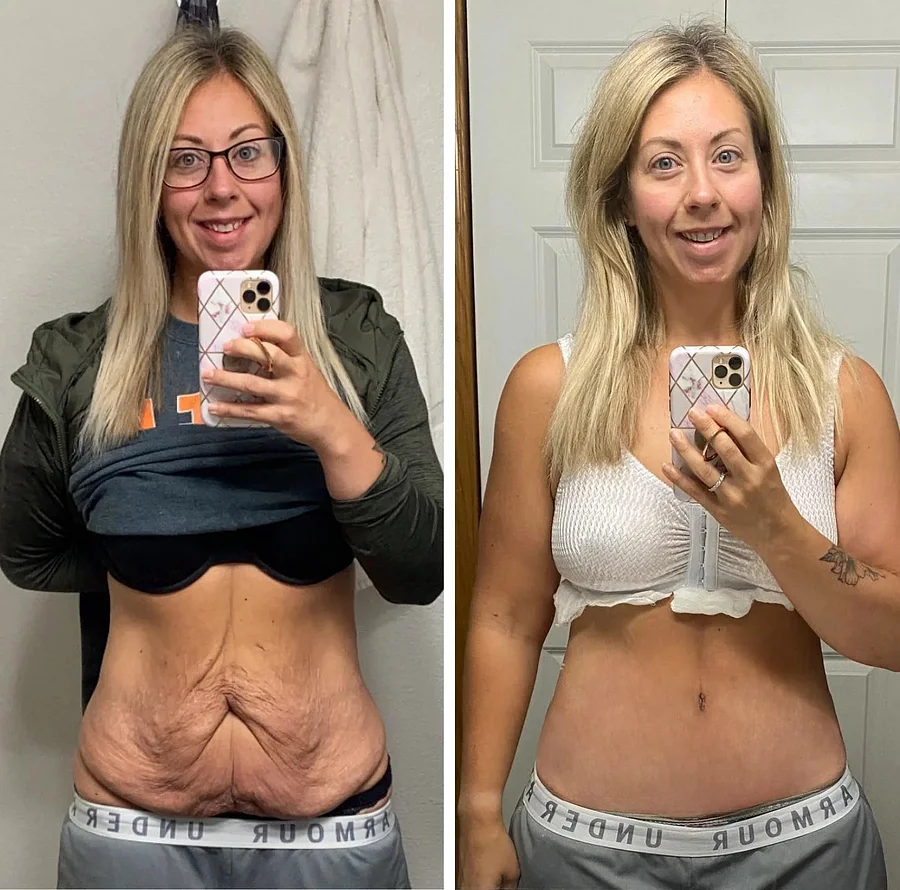 Laozik™ Botox Bee poison Firming Serum Stick