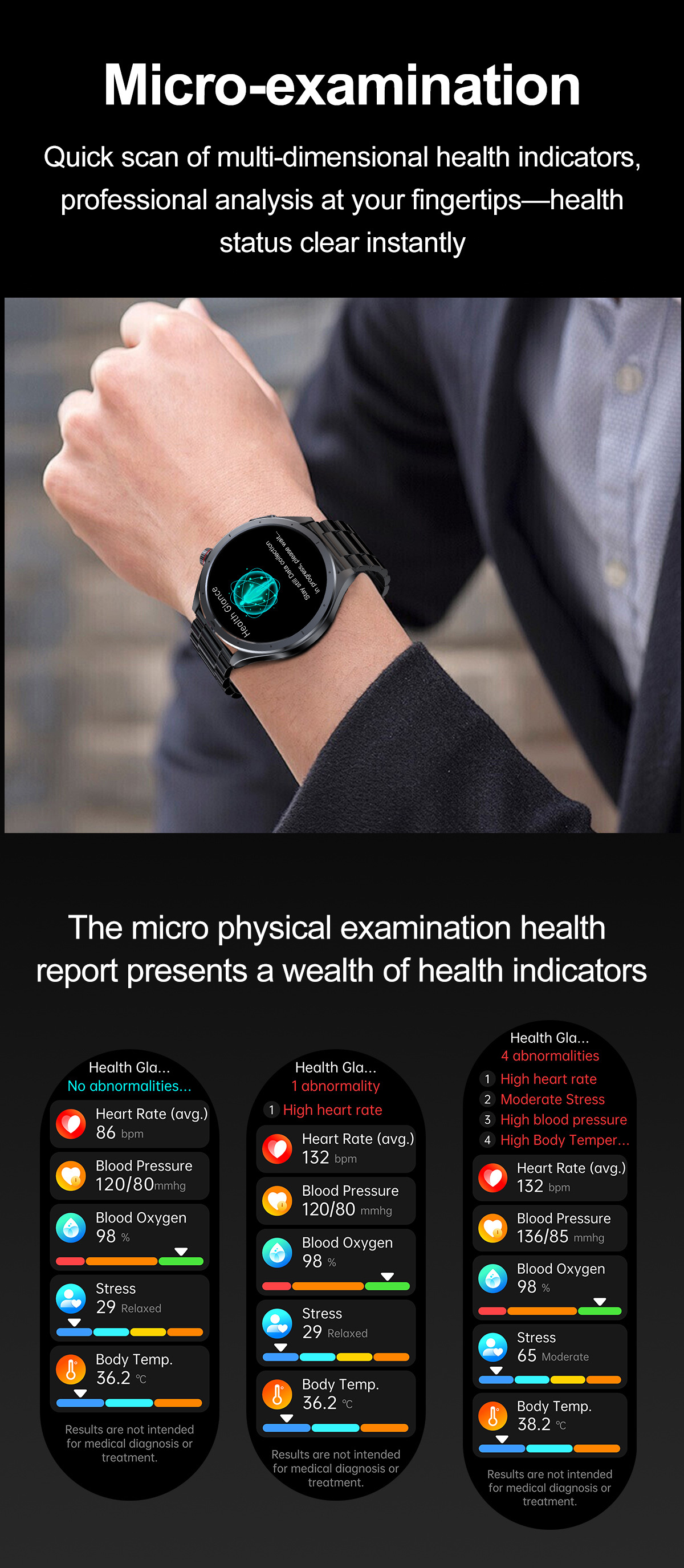 Likron Watches