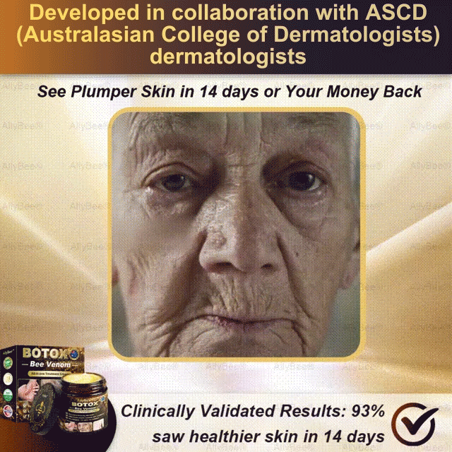 Botox Anti-Aging Skin Cream