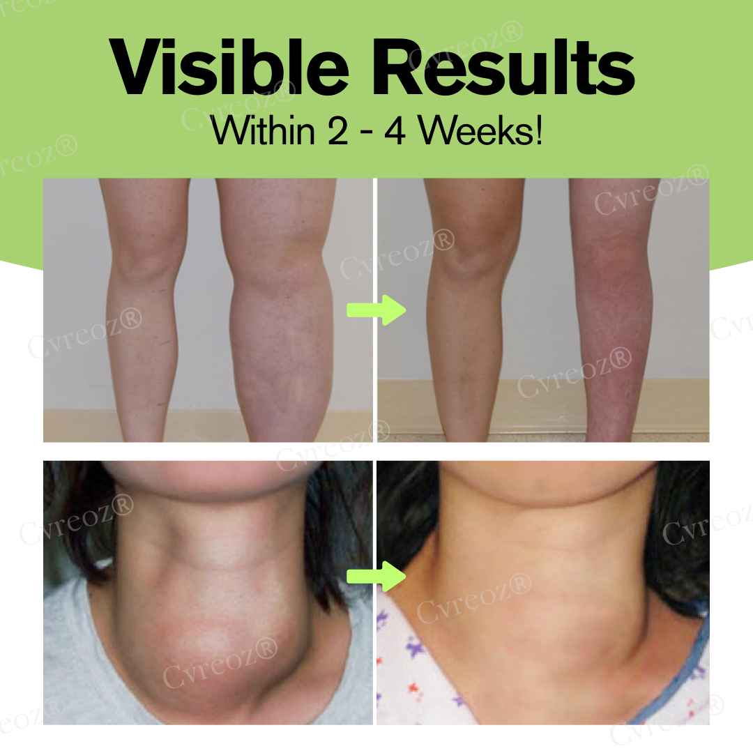 🔥Hot Sale 49% Off🔥 Herbal Lymphatic Detox Cream