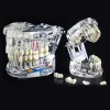 Dental Restoration Model Oral Pathology Doctor-Patient Communication Teaching Restoration Comprehensive With Nerve Part Removable Tooth Model