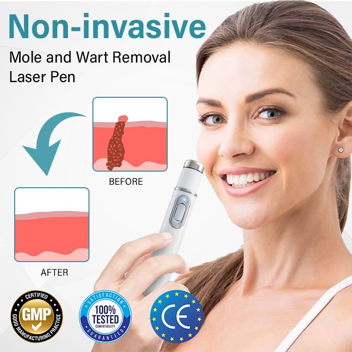 	BQYOOM&trade; MoleLaser Painless Laser Mole Removal Pen