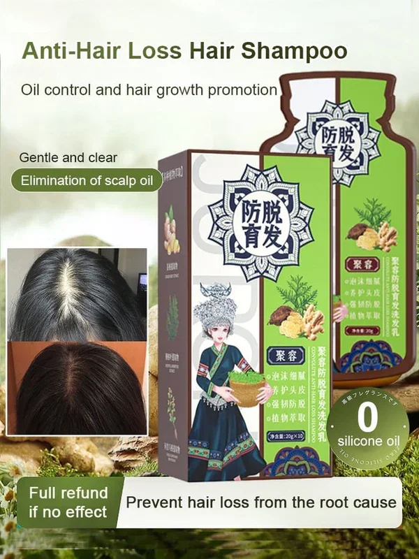 ✨Last Day Promotio🎁Hot Sale Ginger Plant Extract Anti-Hair Loss Hair Shampoo