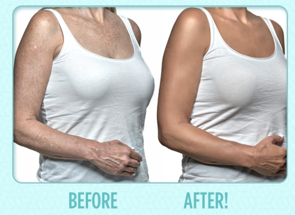 Instant Body Concealer, Instant Body Concealer