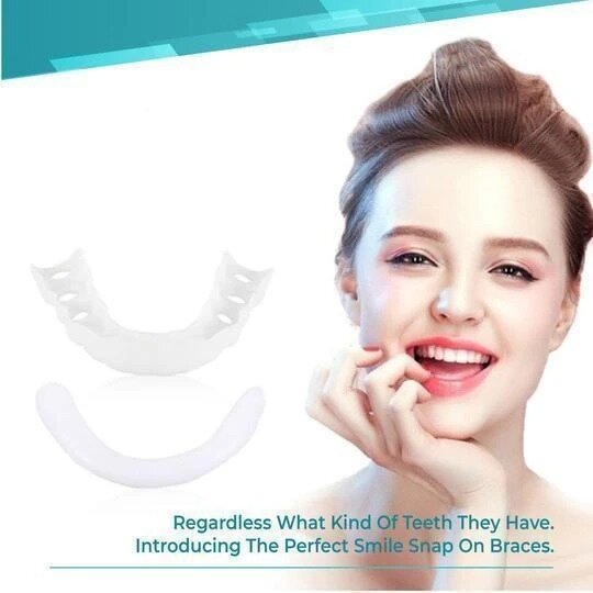 🎉50% OFF🎉PERFECT SMILE SNAP-ON BRACES