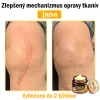 🧑&zwj;⚕️O&scaron;etrenie kožn&yacute;ch probl&eacute;mov zahňa: vekov&eacute; &scaron;kvrny, jazvy, bradavice, kožn&eacute; akn&eacute;, furuncle, akn&eacute;, ekz&eacute;my, psori&aacute;za, acne inversa, akn&eacute;, jazvy po akn&eacute; a in&eacute;.