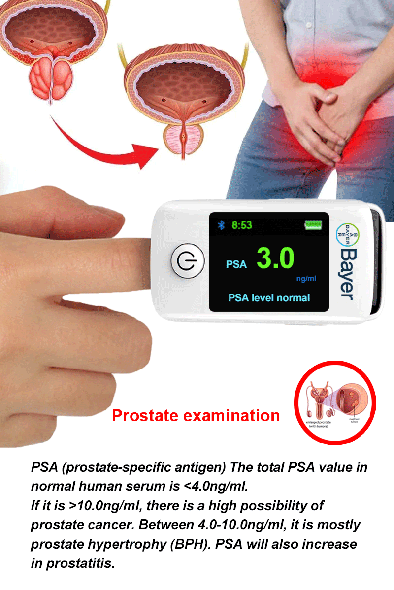 Esame della prostata.gif