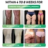 Loja oficial | LAOZIK&trade; 🎁 GLP-1 e solu&ccedil;&atilde;o de sa&uacute;de Solu&ccedil;&atilde;o oral 6 em 1 (apenas uma vez ao dia, veja mudan&ccedil;as vis&iacute;veis em 7 dias) ✅ Adequado para obesidade, sa&uacute;de cardiovascular, diabetes, apneia do sono, problemas nas articula&ccedil;&otilde;es, etc.