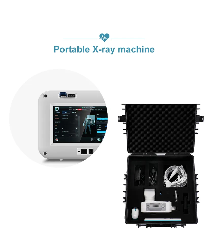 XR-705 Best Quality Portable Digital X Ray Machine Mobile Handheld