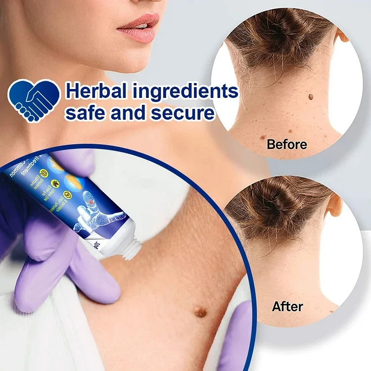 Instant Blemish Removal Gel 