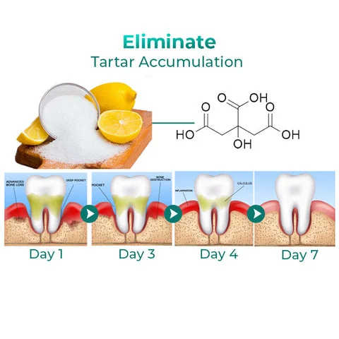 SmileMate™ Removal of tartar and plaque bacteria and various oral problems
