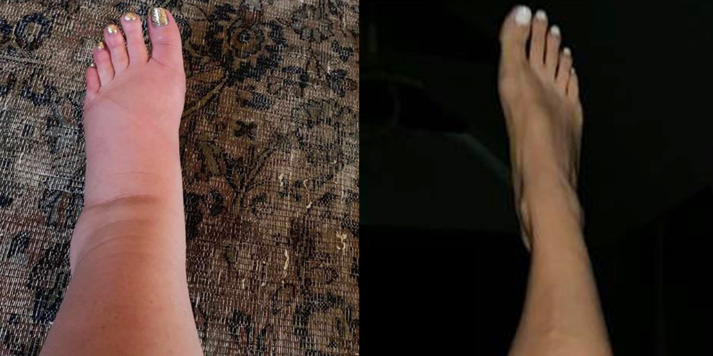 Jessica Simpson shares photo of post-baby leg transformation