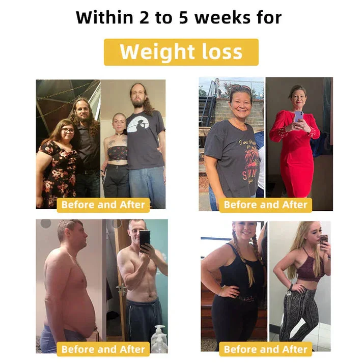 👩&zwj;⚕️👩&zwj;⚕️ 𝐂𝐯𝐫𝐞𝐨𝐳&trade; 𝐁𝐞𝐞 𝐕𝐞𝐧𝐨𝐦 𝐒𝐥𝐢𝐦𝐦𝐢𝐧𝐠 𝐏𝐚𝐭𝐜𝐡 🔥 (𝐟𝐨𝐫 𝐚𝐥𝐥 𝐥𝐲𝐦𝐩𝐡𝐚𝐭𝐢𝐜 𝐩𝐫𝐨𝐛𝐥𝐞𝐦𝐬 𝐚𝐧𝐝 𝐨𝐛𝐞𝐬𝐢𝐭𝐲)