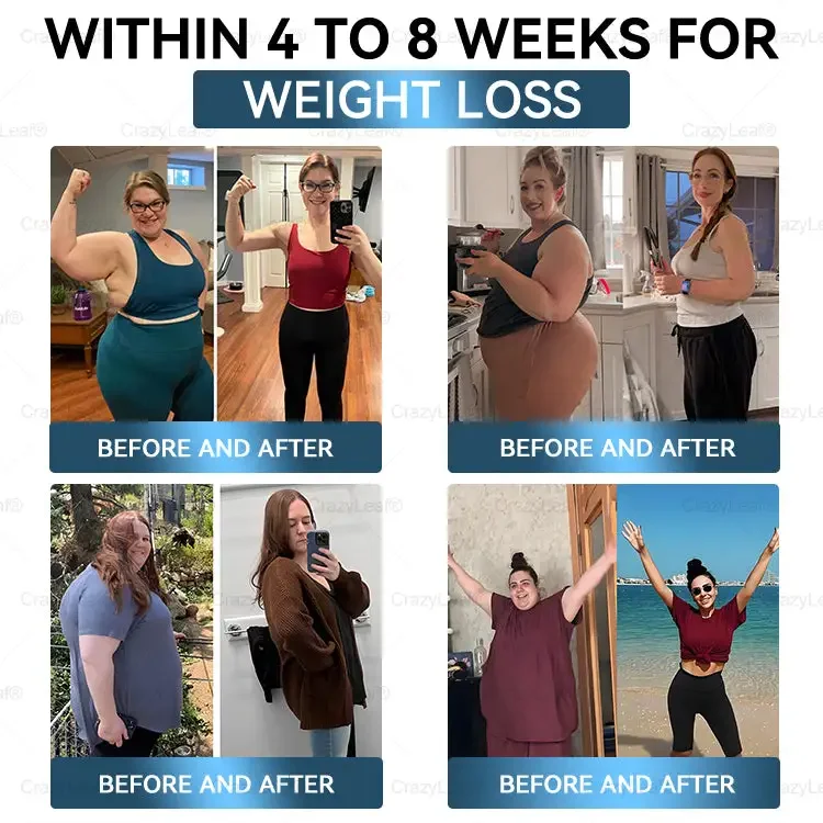 	CrazyLeaf&reg; Sculpting Microneedle Patch