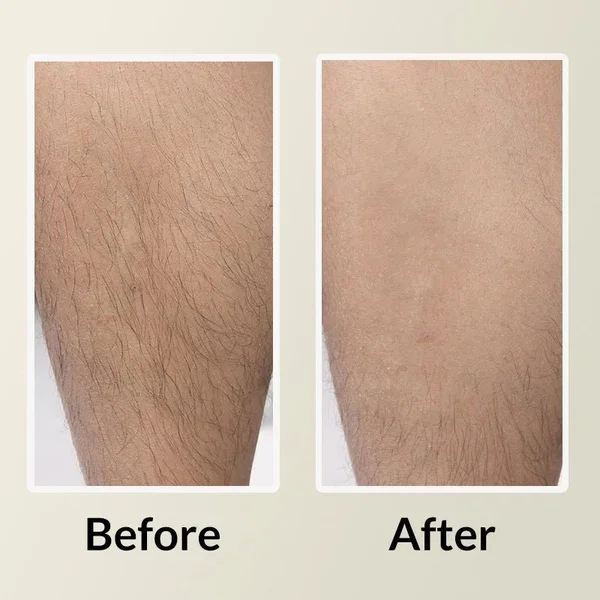 🔥BUY 1 GET 1 FREE &ndash; CRYSTAL HAIR ERASER