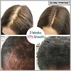 🎉Hot sale-49%OFF--SCALP INTENSE - HAIR GROWTH SERUM