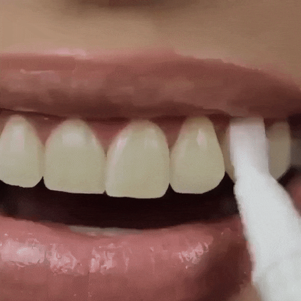 lapiz blanqueador de dientes