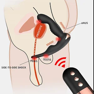 Anal Plug Pull Prostate Massager Adult Products  – Wireless Remote Control Double Shock Sex Masturbator