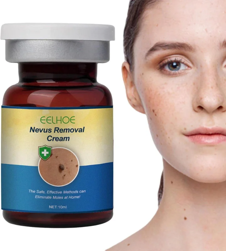 Non-Invasive Mole Removal