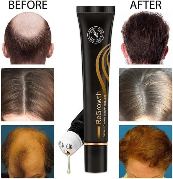 Organic Hair Serum Roller 🔥HOT DEAL - 50% OFF🔥