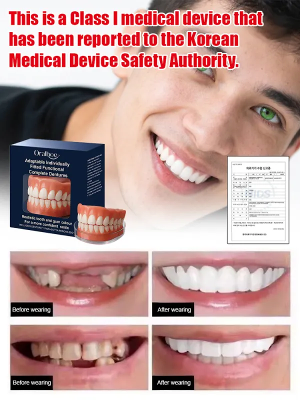 Functional complete denture restoration kit