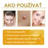 🧑&zwj;⚕️O&scaron;etrenie kožn&yacute;ch probl&eacute;mov zahňa: vekov&eacute; &scaron;kvrny, jazvy, bradavice, kožn&eacute; akn&eacute;, furuncle, akn&eacute;, ekz&eacute;my, psori&aacute;za, acne inversa, akn&eacute;, jazvy po akn&eacute; a in&eacute;.