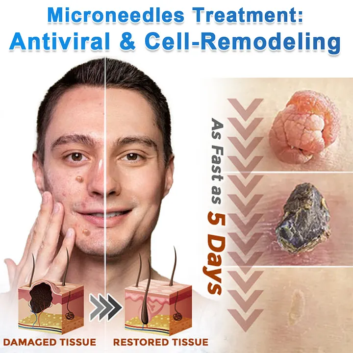 OWIWELL® 2-in-1 Microneedle & Hydrocolloid Patch