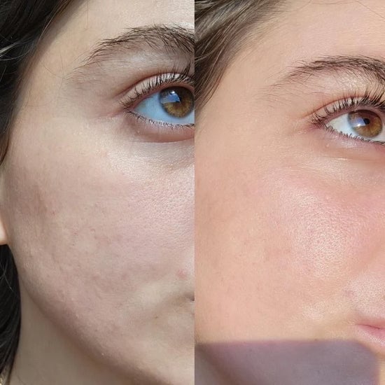 After 8 Weeks