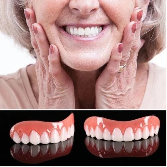 SMILE VENEER