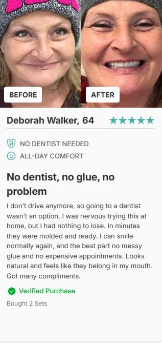 Deborah Walker Before After