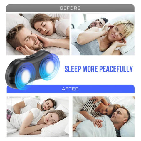 Anti snoring device