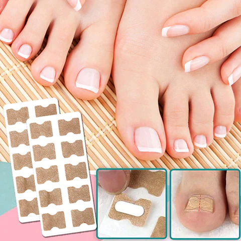 【49% OFF，BUY ONE GET ONE FREE】 CORRECTION PATCHES FOR BEAUTIFUL AND HEALTHY NAILS