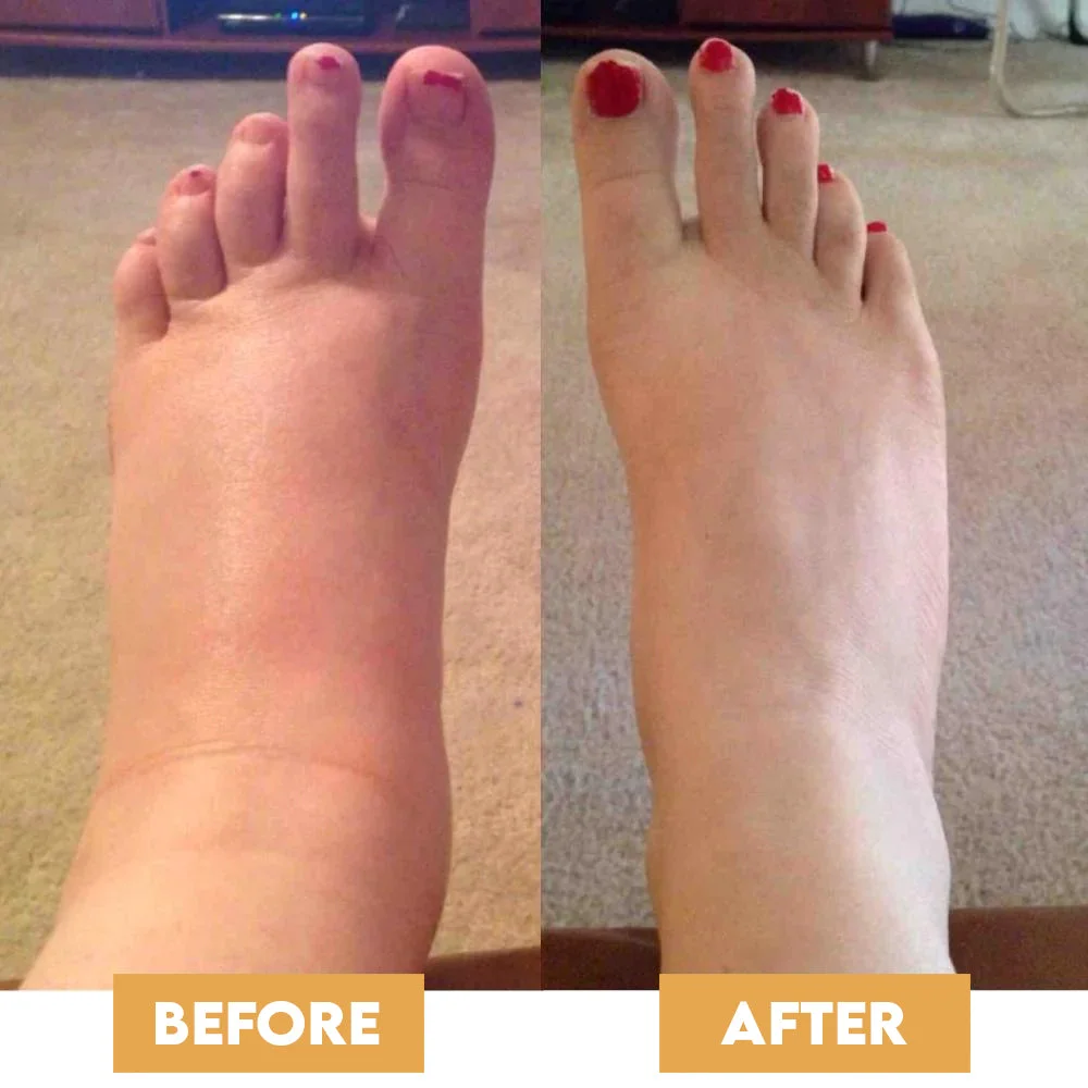 ProFeet™ - EMS Foot Massager