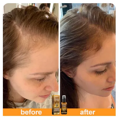 Image showcasing Biotin Hair Growth Serum
