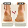 Nouveau Appareil de R&eacute;paration et de Pon&ccedil;age des Pieds Rechargeable par USB