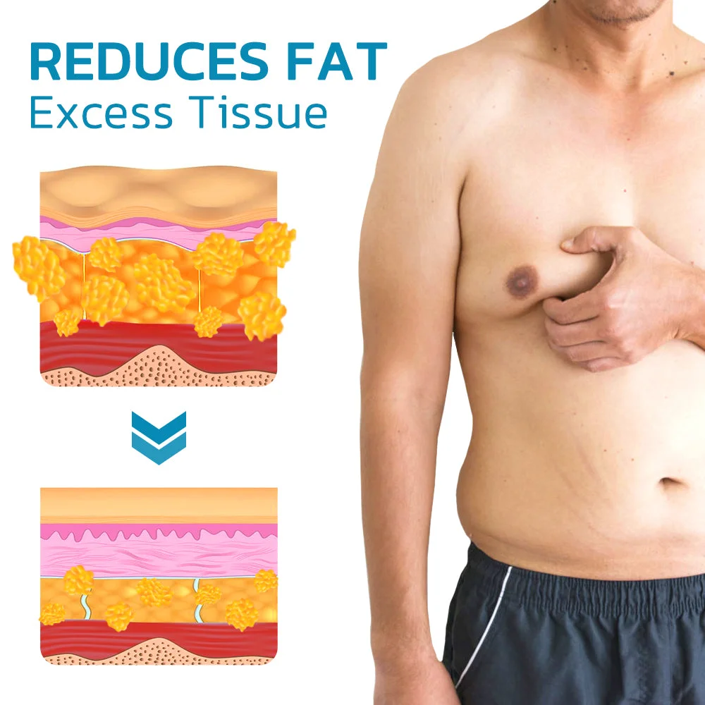 GFOUK&trade; GKTY Gynecomastia Compress Tank Top