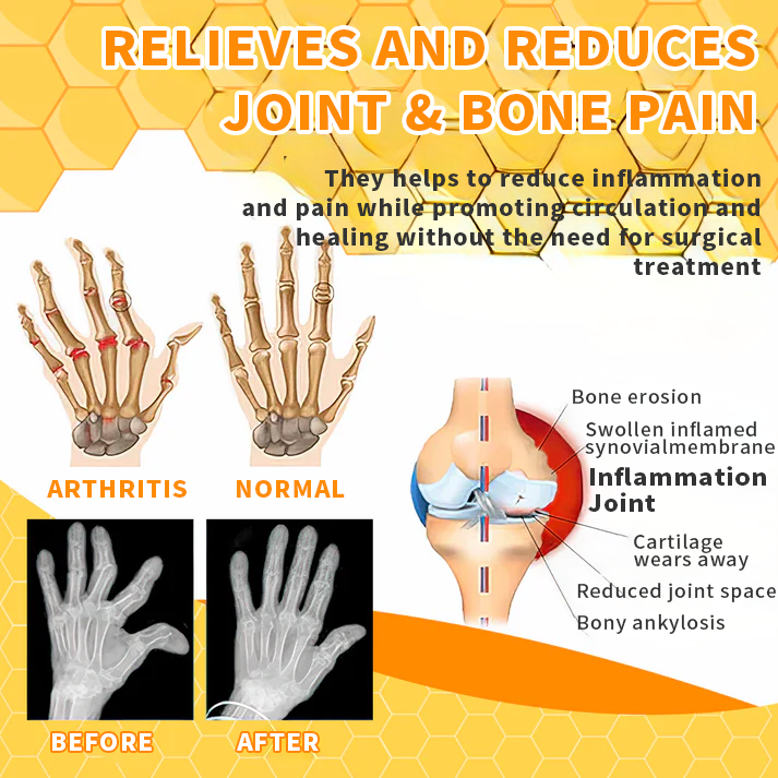 🐝AQA™ Bee Venom Joint Therapy Pain Relief Gel(🔥Limited Time Discount 🔥 Last Day🔥)