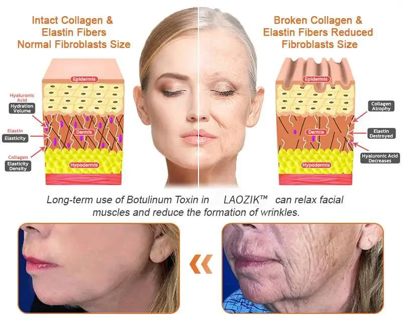 Laozik™ Botox Bee poison Firming Serum Stick