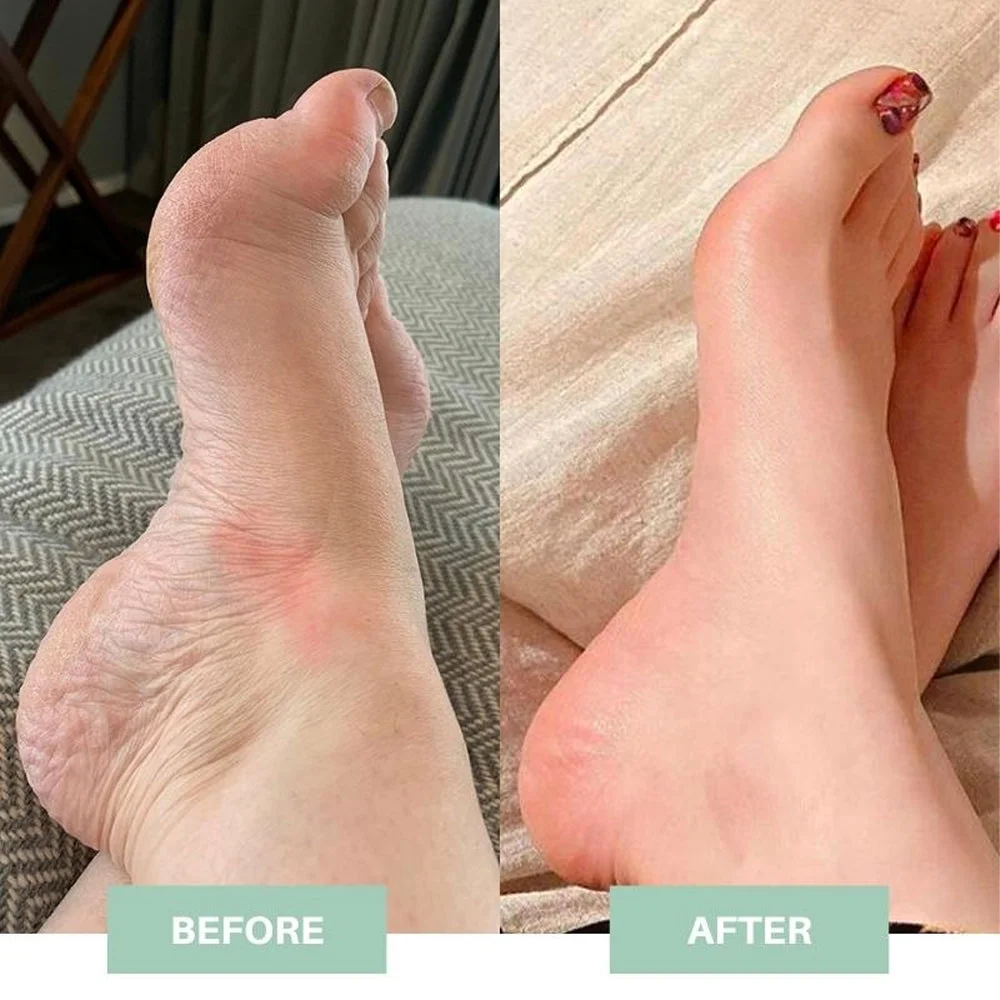 ProFoot&trade; - EMS Foot Massager