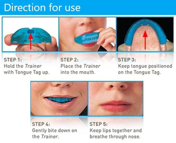 Do Clear Orthodontic Aligners Really Work